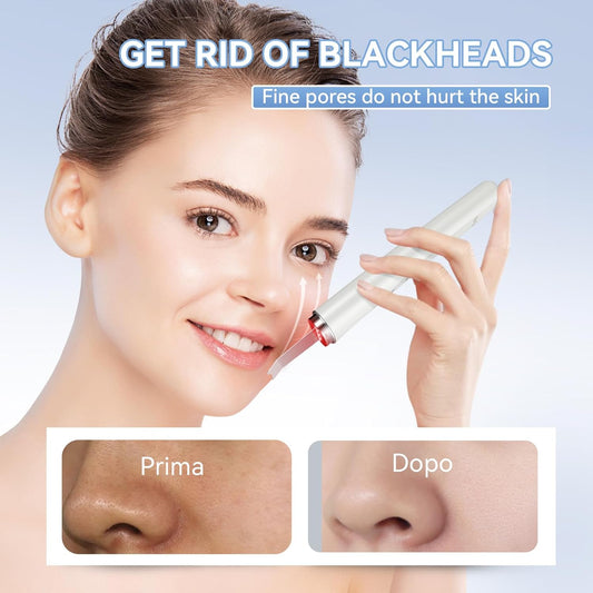 Vitalit™ SilkTouch Pro – Ultrazvučni piling sa svjetlosnom terapijom